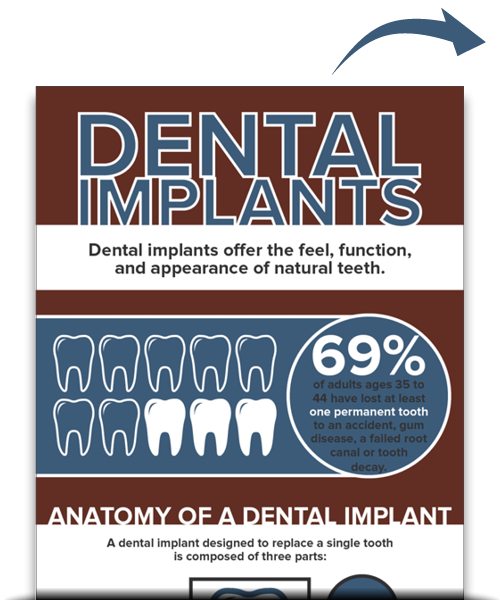 Dental Implants Free Ebook placeholder