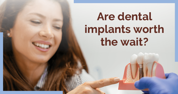 How Long Does a Dental Implant Procedure Take?